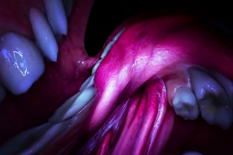Björk, Mouthmantra, diretto da Jesse Kanda, 2015