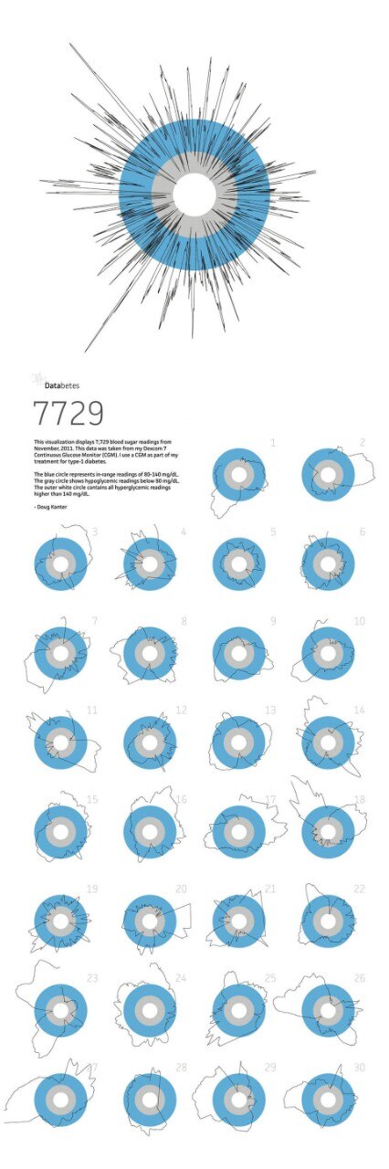 Glucose levels in Doug
Kanter’s bloodstream,
visualised using Processing.
The individual circles
represent daily values, while
the larger circle (top) is a
comparison of the entire
month’s data Glucose levels in Doug
Kanter’s bloodstream,
visualised using Processing.
The individual circles
represent daily values, while
the larger circle (top) is a
comparison of the entire
month’s data
