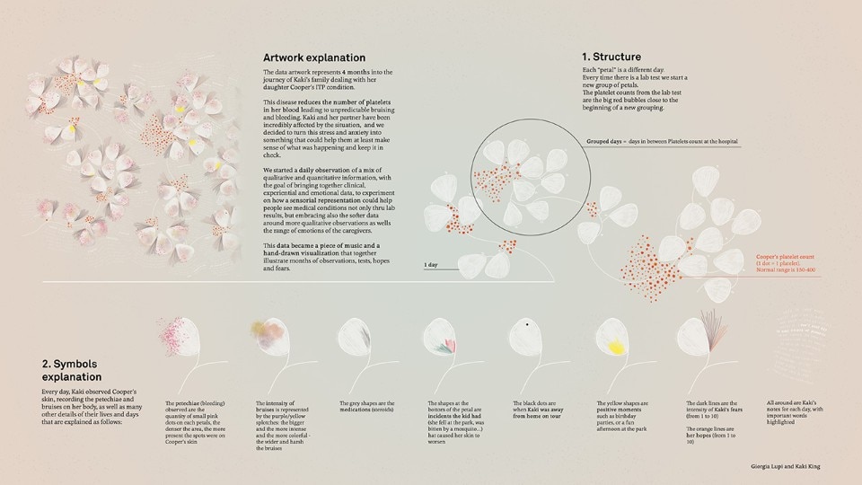 Fig.3 Giorgia Lupi, Kaki King, “Bruises – The Data We Don’t See” 